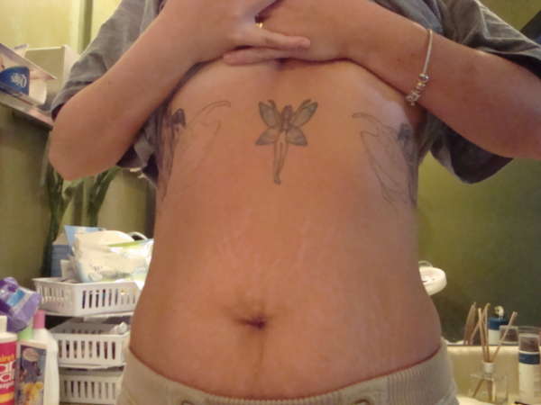 Rib-fairy wings. (unfinished) tattoo
