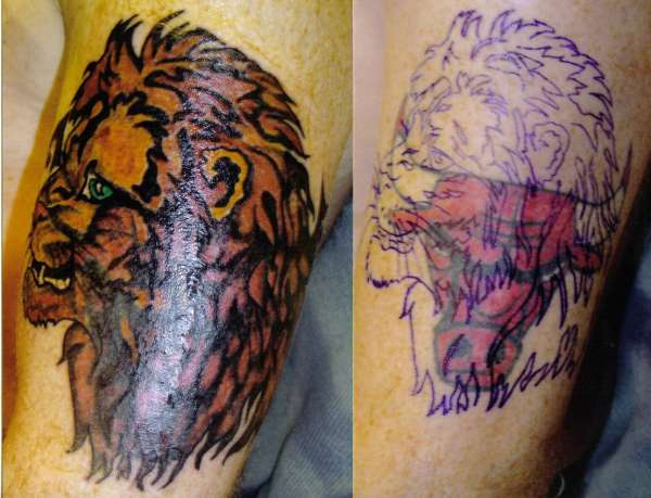 coverup tattoo