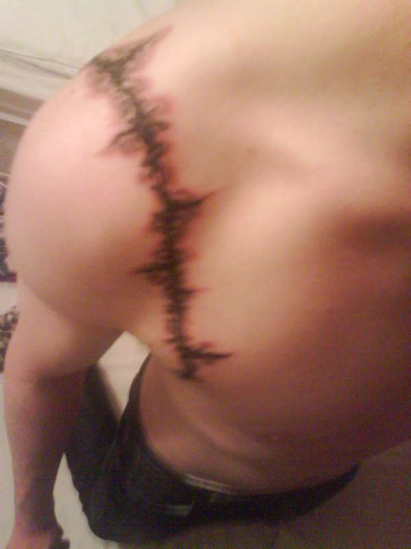 stitching tattoo