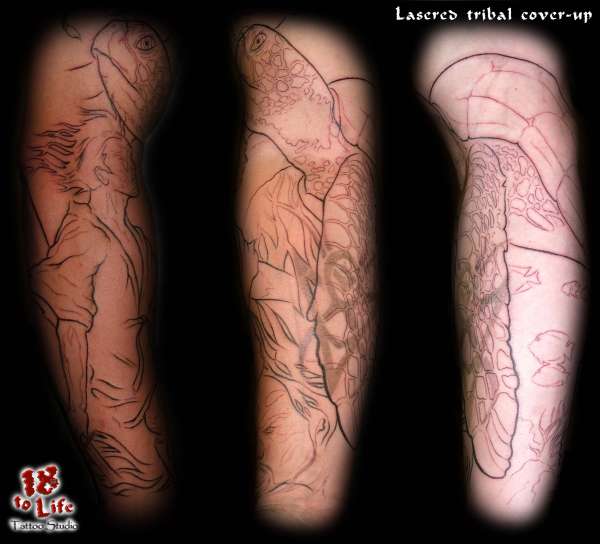 laser removal cover up tattoo