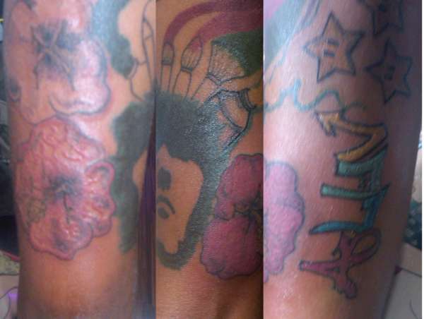 another cover-up in process tattoo