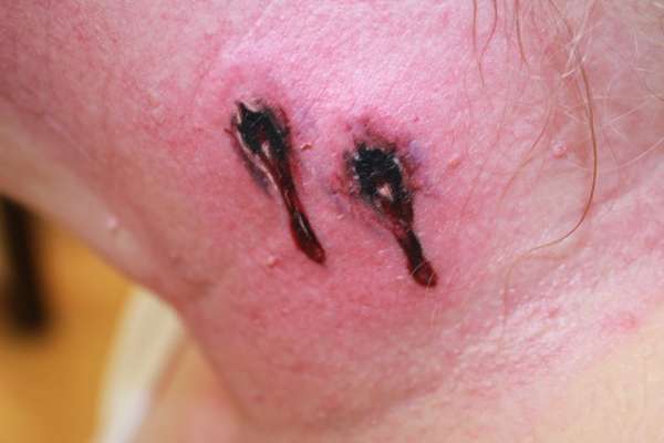 Vampire Bites tattoo