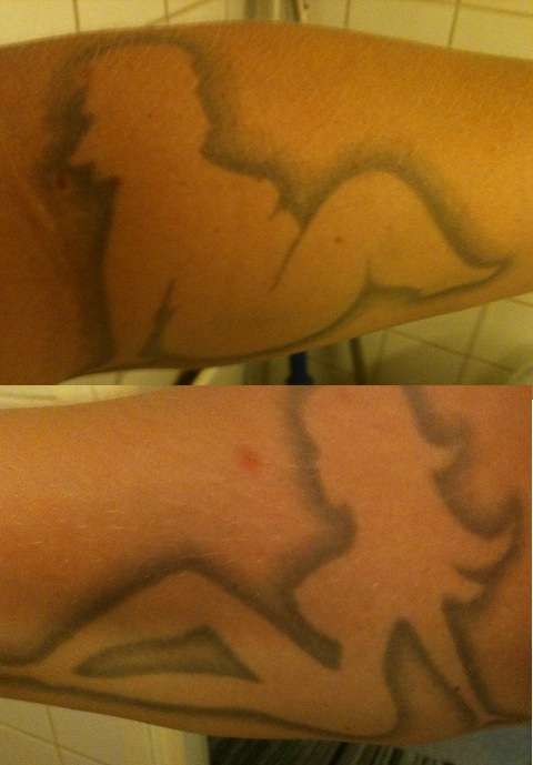 right and left arm lol tattoo