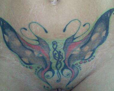 painful butterfly tattoo