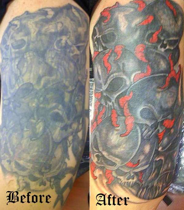 b4 after tattoo