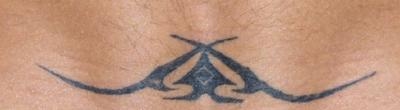Before tattoo