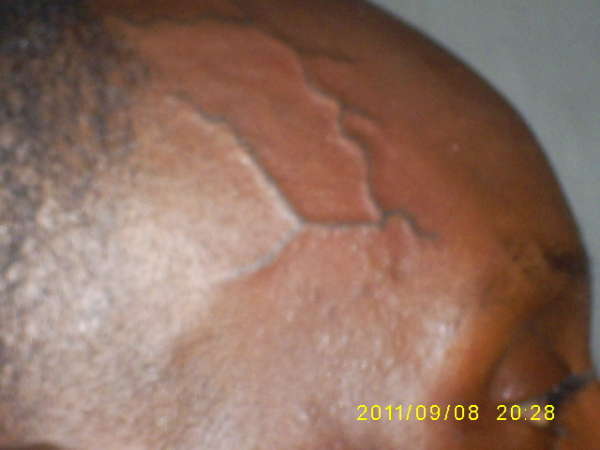Veins in Head tattoo