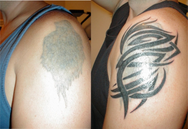 b4&after tattoo