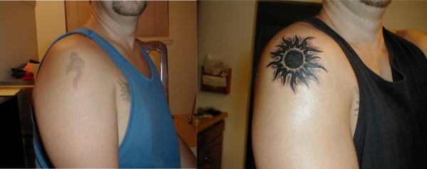 b4&after2 tattoo