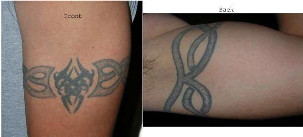 My Armband tattoo