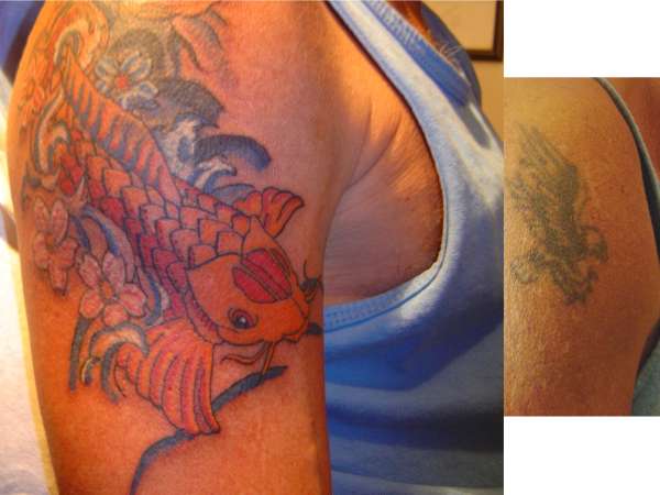 Coverup_Koi tattoo