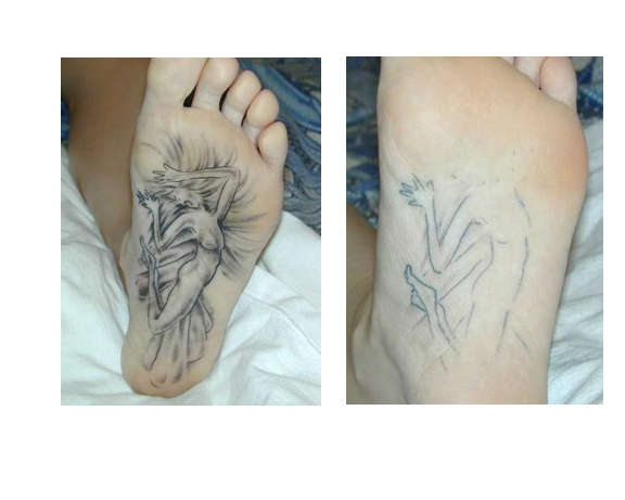 Squished Fairy Tattoo tattoo