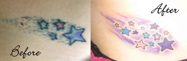Stars on my hip Before and After tattoo