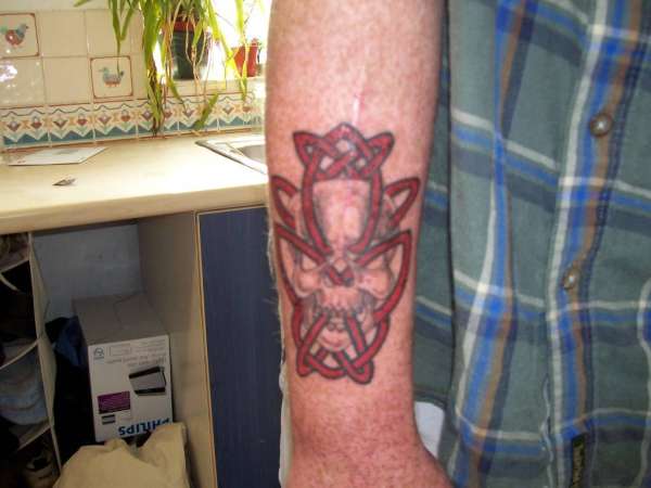 Skull/celtic - (scar cover up) tattoo
