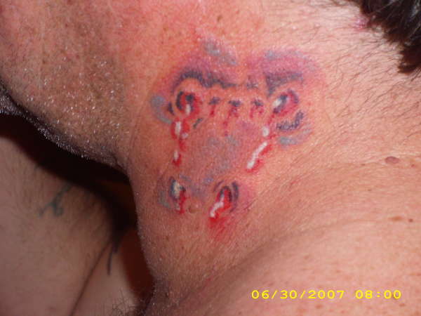 vampire bite tattoo