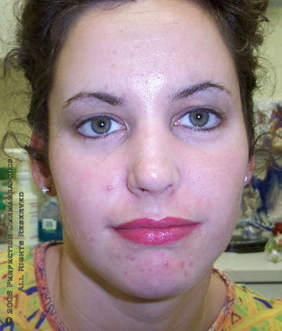 Eyeliner, Lip tattooing by Kate Ciampi, Perfection Dermagraphics tattoo
