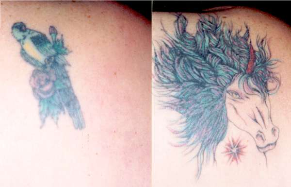 cover-up unicorn tattoo