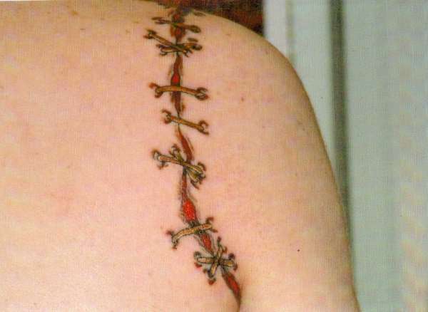 cut off arm tattoo