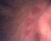 Hearts tattoo