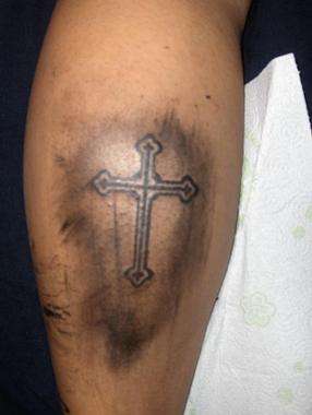 cross tattoo