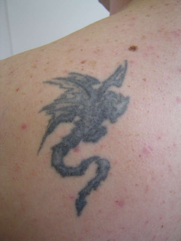 Before coverup tattoo