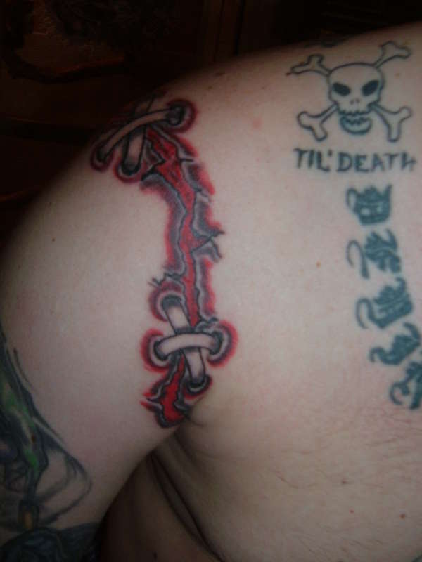 Arm Sewed Back On-cameroncrazies3x6 tattoo