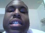 Young OB