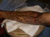 pain