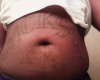 (STOMACH TAT) NAME tattoo