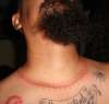 neck scar tattoo
