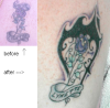 cover up tattoo