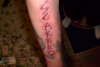 scarred tattoo