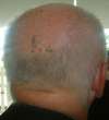 Balding tattoo