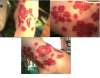 Red hibiscuses tattoo