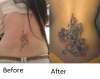 Before and after cover up. tattoo