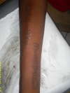 arm tattoo