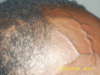 Veins in Head (close up) tattoo