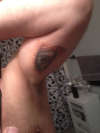 Healed Eye Tattoo