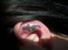 Rose tattoo
