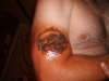 skull tattoo
