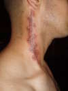 Stitches tattoo