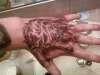 skull and fingure bones tattoo