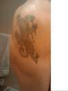 Before tattoo